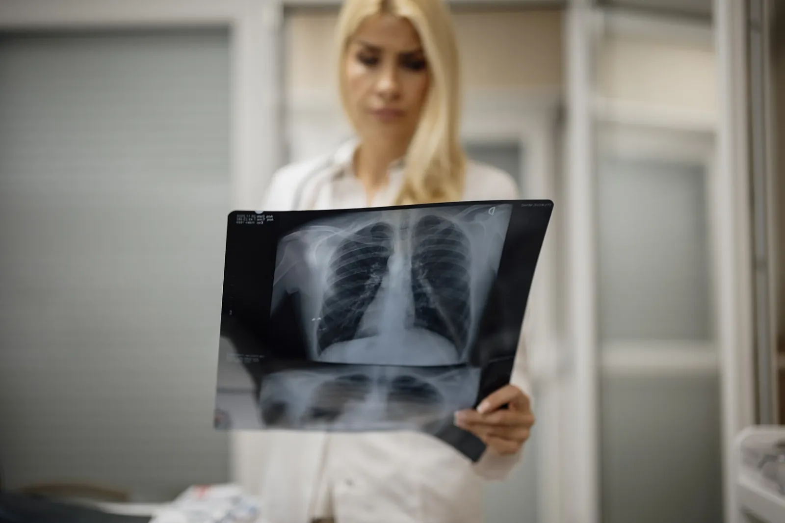 Doctor examining a chest X-ray film